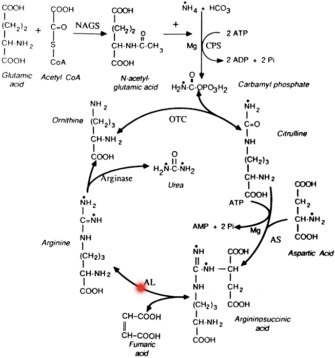  Argininosuccinic Aciduria